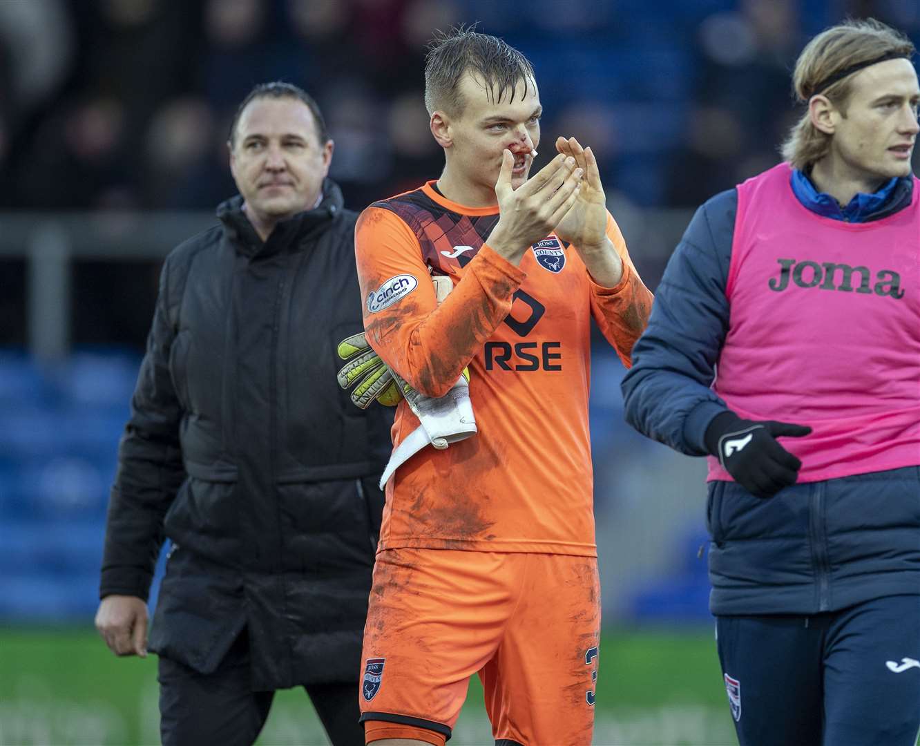 Ross County keeper Ashley Maynard-Brewer exits against Rangers with a broken nose..