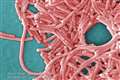 Legionella bacteria can cause serious lung disease that is fatal in 10% of cases