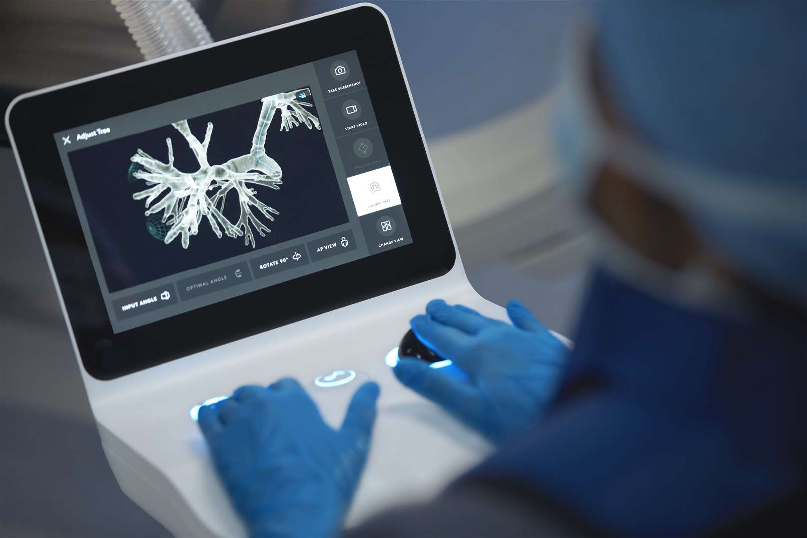 The Ion system gives clinicians access to hard-to-reach areas of the lung and allows them to take biopsies with greater precision (ION/PA)