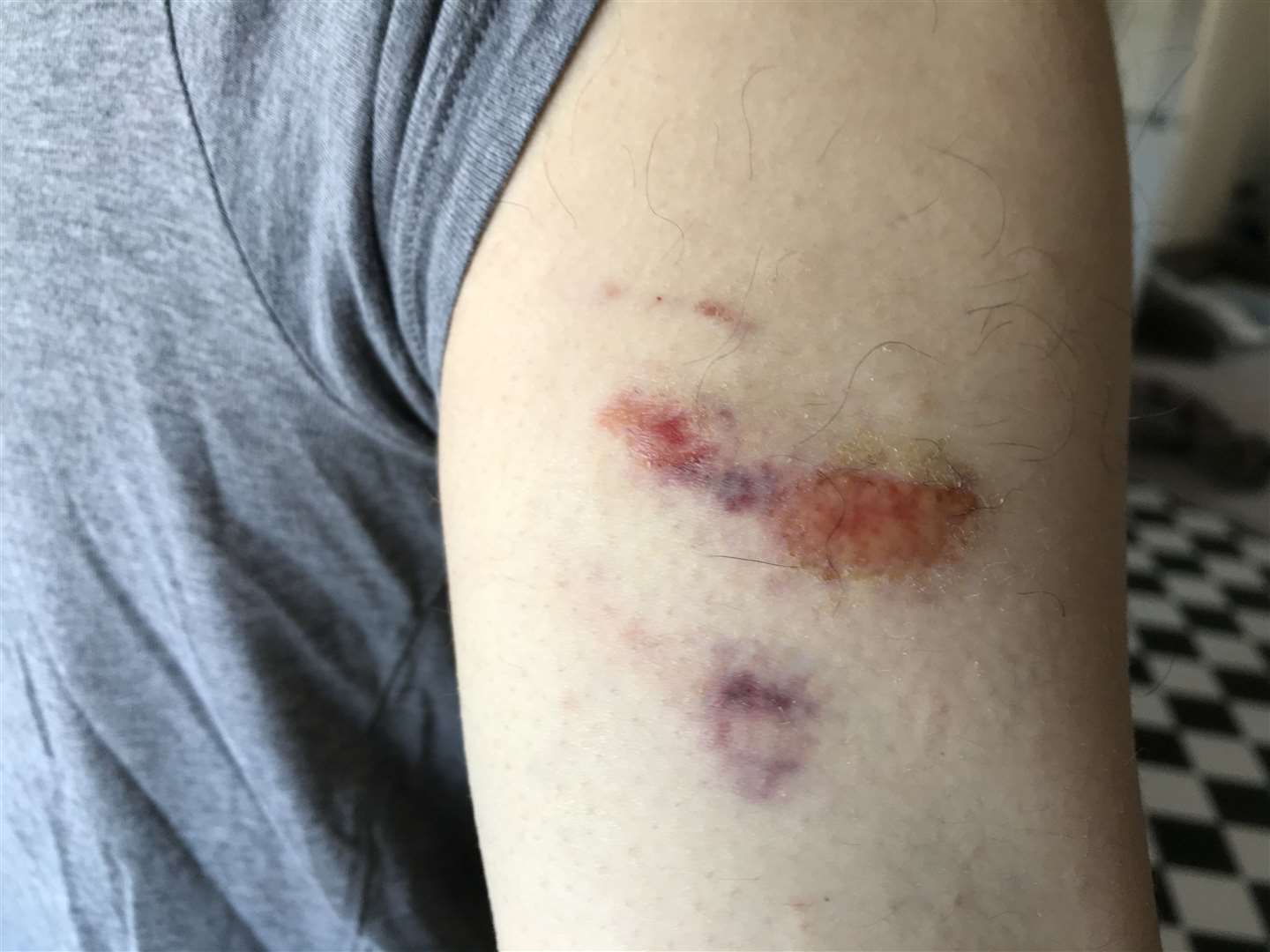 Blair Cowan's arm was bitten by the dog.