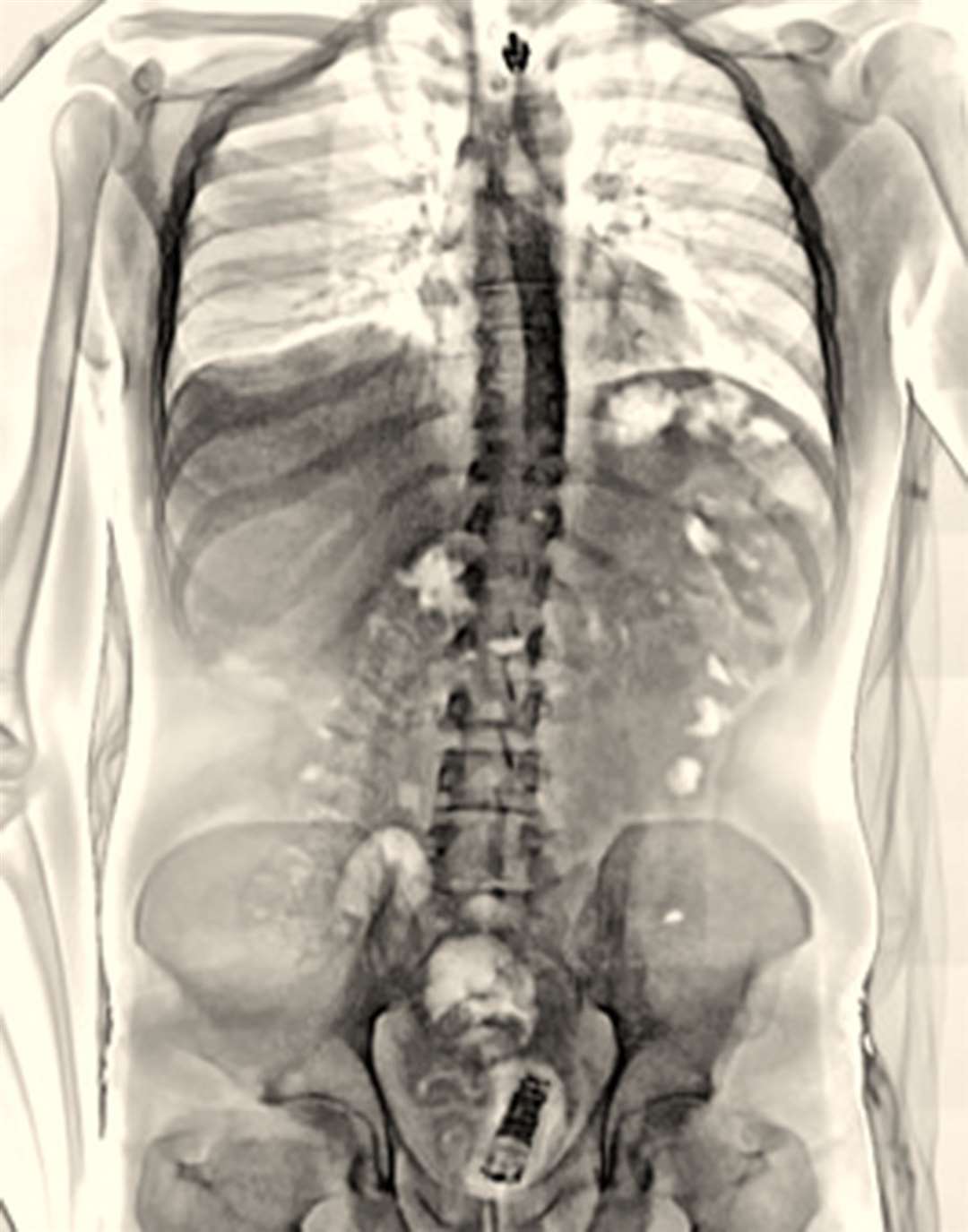 An X-ray body scan of a phone during an attempt to smuggle contraband behind bars (MoJ Handout/PA)