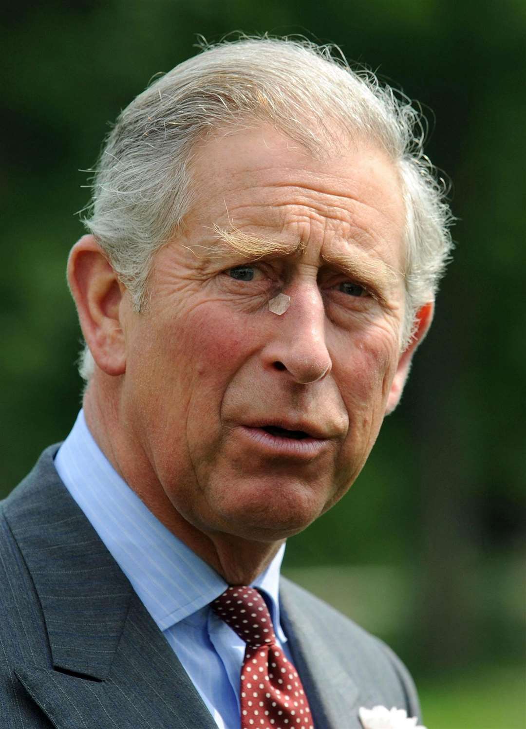 The Prince of Wales with a small plaster on the side of his nose after a minor procedure in 2008 (Barry Batchelor/PA)
